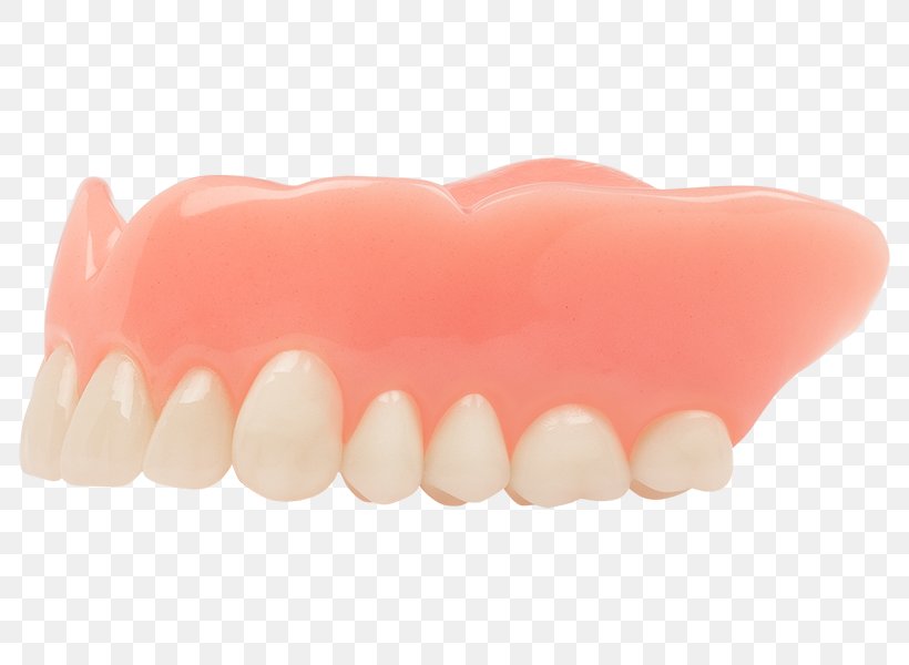 Tooth Dentures Dentistry Human Mouth Aspen Dental, PNG, 800x600px, Tooth, Aspen Dental, Dental Consonant, Dentistry, Dentures Download Free
