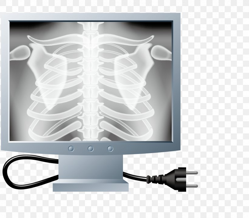 X-ray Rib Bone Cartoon, PNG, 1703x1495px, Xray, Art, Bone, Cartoon, Electron Download Free