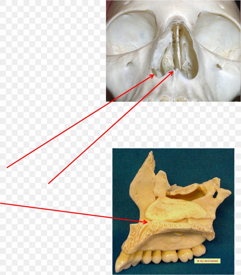 Bone Maxilla Anatomy Joint Skeletal Pneumaticity, PNG, 939x1068px, Bone, Anatomy, Cartilage, Human Skeleton, Jaw Download Free