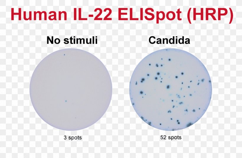 ELISPOT Assay B Cell Granzyme Secretion, PNG, 870x570px, Assay, Antigen, Area, B Cell, Brand Download Free