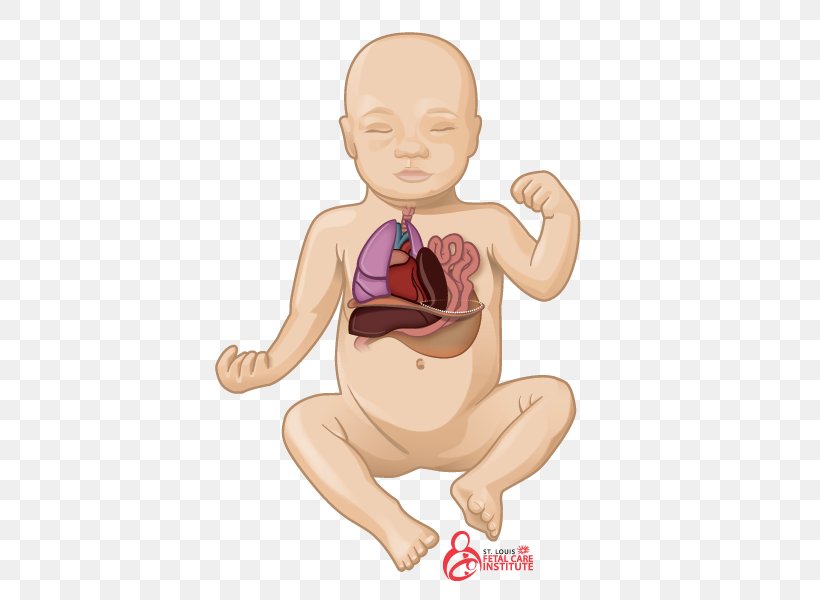 Pulmonary Hypoplasia Congenital Pulmonary Airway Malformation Congenital Diaphragmatic Hernia Lung, PNG, 600x600px, Watercolor, Cartoon, Flower, Frame, Heart Download Free