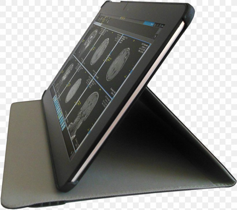 Smartphone Medical Imaging Computer Monitors Picture Archiving And Communication System, PNG, 1189x1053px, Smartphone, Communication Device, Computer, Computer Hardware, Computer Monitors Download Free