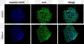 Human Cell - Induced Pluripotent Stem Cell Oct-4 Staining PNG