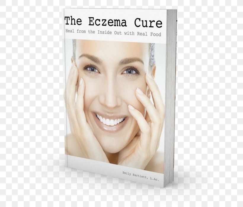 The Eczema Cure Emily Bartlett Cosmetics Healing, PNG, 600x700px, Cosmetics, Beauty, Blond, Cheek, Chin Download Free