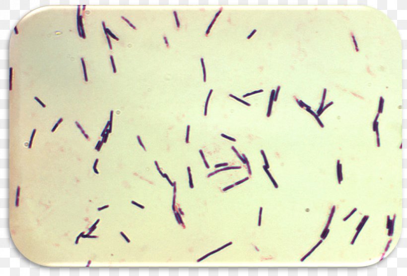 Clostridium Perfringens Food Poisoning Bacteria Clostridium Botulinum Clostridium Difficile, PNG, 828x563px, Food Poisoning, Bacillus, Bacteria, Clostridium, Clostridium Botulinum Download Free