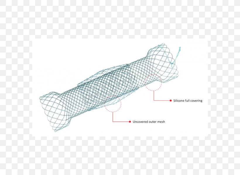 Stenting Esophageal Varices Esophagus, PNG, 600x600px, Stenting, Esophageal Varices, Esophagus, Price, Structure Download Free