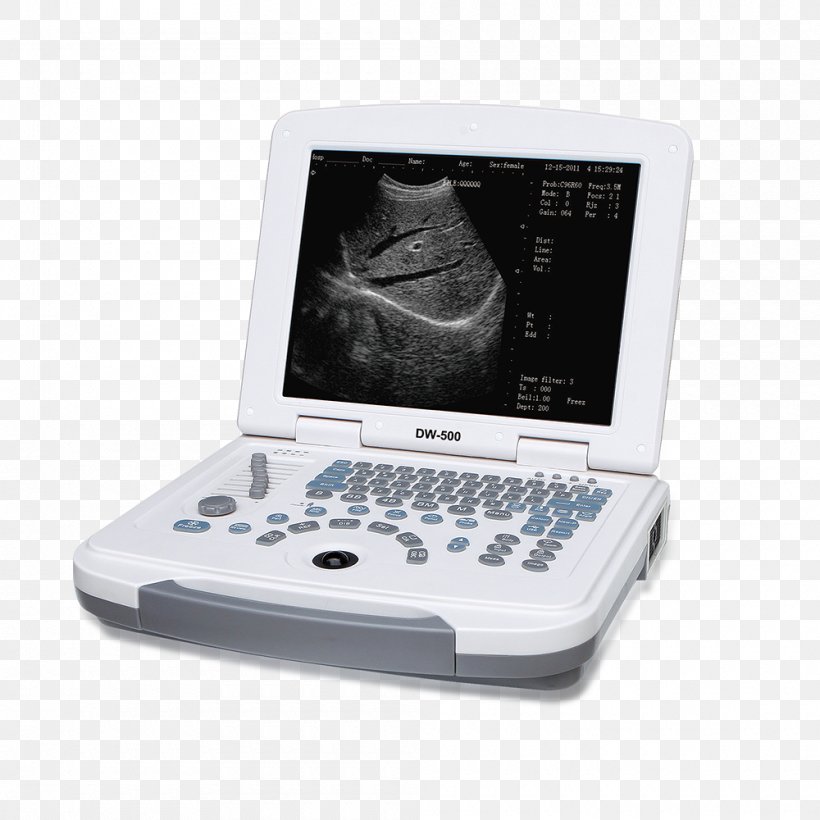 Ultrasonography 3D Ultrasound Medicine Medical Equipment, PNG, 1000x1000px, 3d Ultrasound, Ultrasonography, Display Device, Doppler Echocardiography, Electronic Device Download Free