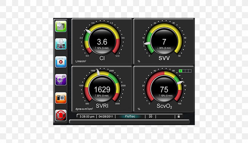 Edwards Lifesciences Hemodynamics Monitoring Cardiac Output Stroke Volume, PNG, 998x575px, Edwards Lifesciences, Anaesthesiologist, Audio, Audio Equipment, Bair Hugger Download Free