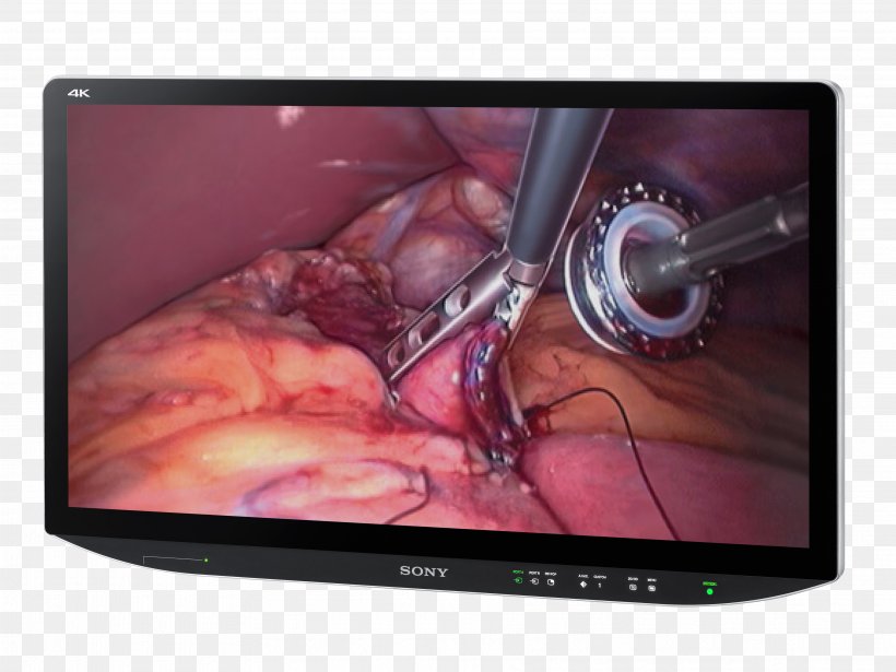 Computer Monitors Sony Corporation 4K Resolution Surgery Television, PNG, 3642x2734px, 4k Resolution, Computer Monitors, Company, Consumer Electronics, Display Device Download Free