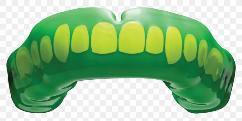 Mouthguard Jaw Dentures, PNG, 1024x512px, Mouthguard, Child, Dentures, Economy, Factory Download Free