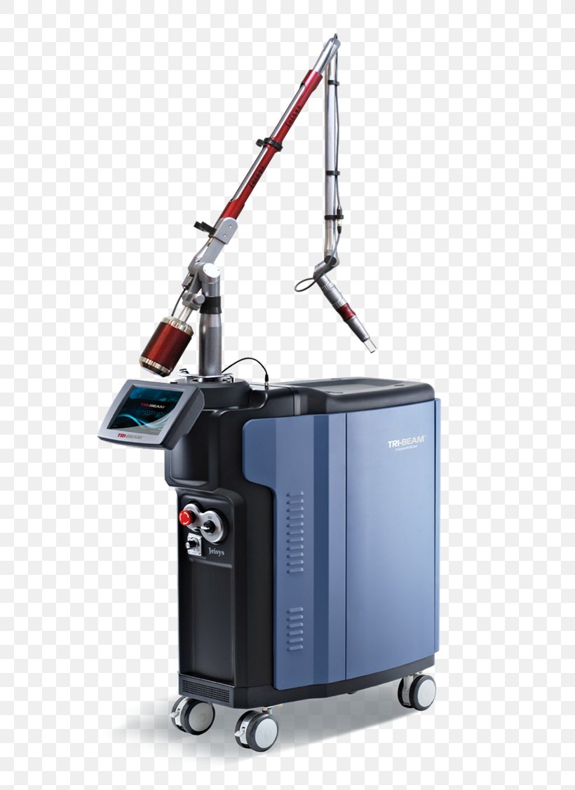 Q-switching Nd:YAG Laser Wavelength Pulse, PNG, 614x1127px, Qswitching, Hyperpigmentation, Laser, Laser Diode, Laser Surgery Download Free