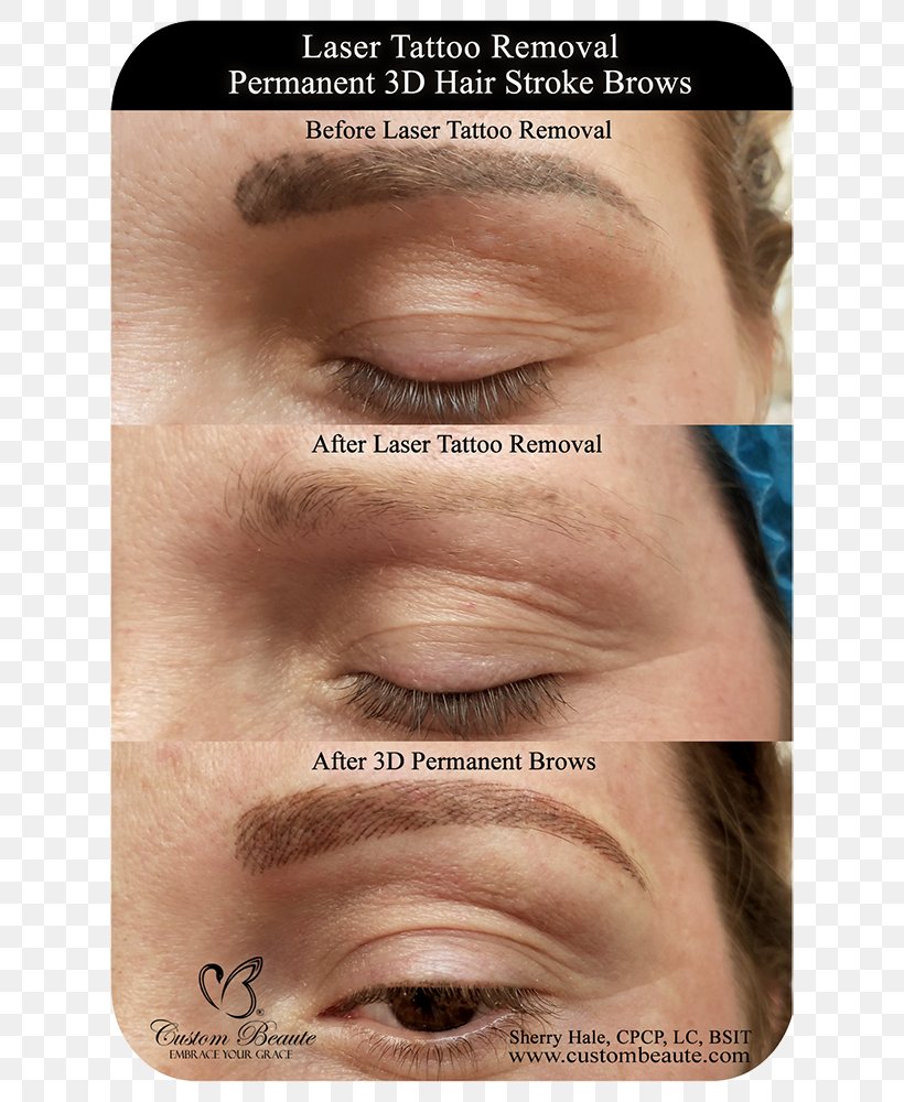 Eyebrow Tattoo Removal Permanent Makeup Laser, PNG, 667x1000px, Eyebrow, Cheek, Chin, Close Up, Cosmetics Download Free