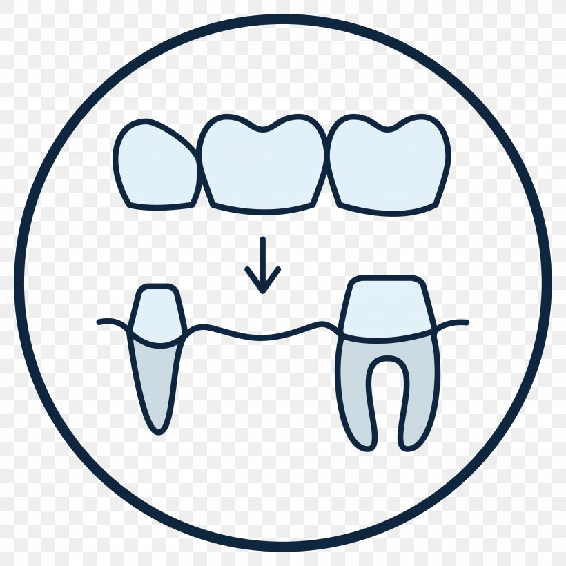 Tooth Dentist Crown Dentures Streeter Dental, PNG, 2084x2084px, Watercolor, Cartoon, Flower, Frame, Heart Download Free