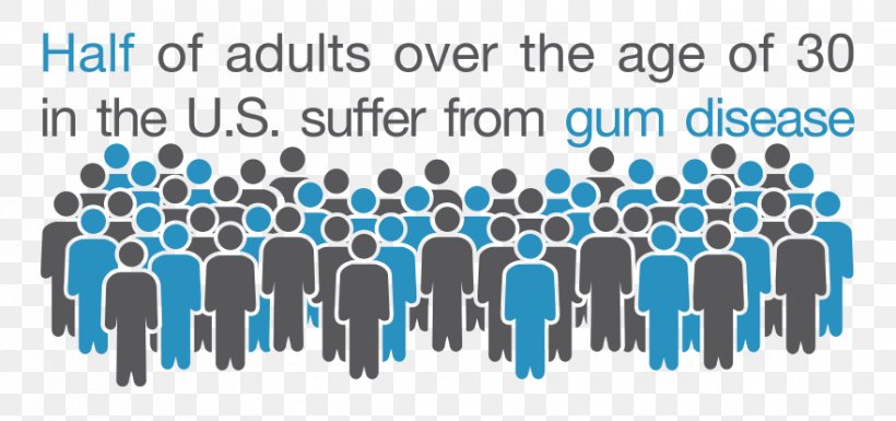 Periodontal Disease Gums Bleeding On Probing Therapy, PNG, 880x414px, Periodontal Disease, Bleeding On Probing, Blue, Brand, Communication Download Free