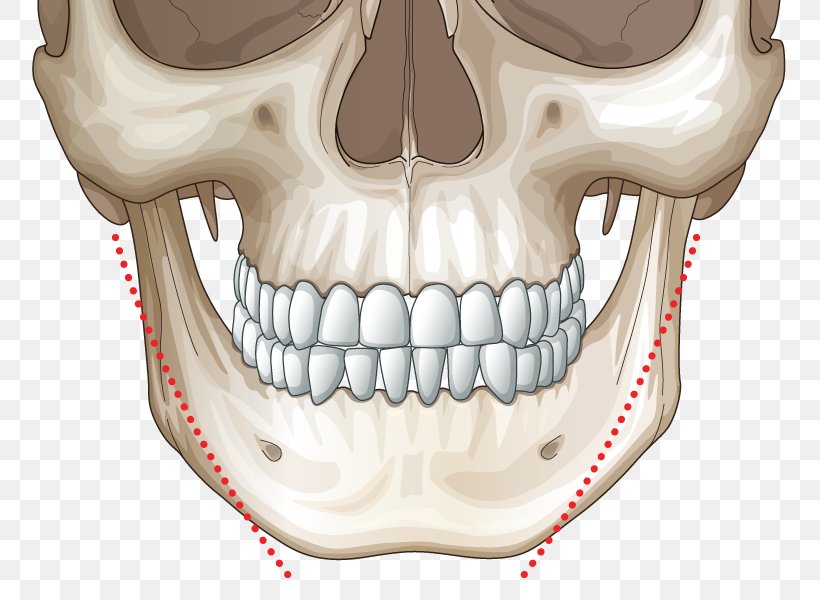 Surgery Intervenție Chirurgicală Face Mandible Chin, PNG, 800x600px, Surgery, Bone, Chin, Ear, Face Download Free