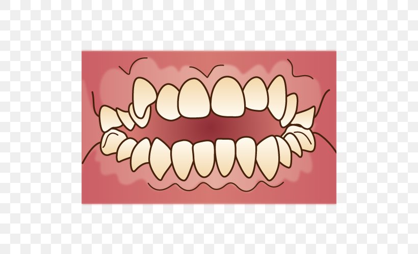 矯正歯科 Dental Braces Dentist Therapy Dentition, PNG, 500x500px, Watercolor, Cartoon, Flower, Frame, Heart Download Free