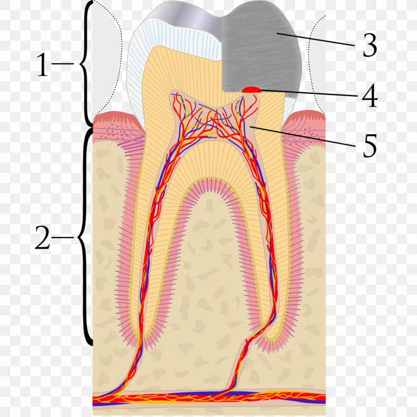 Pulp Capping Pulpitis Endodontic Therapy Dentist, PNG, 1200x1200px, Watercolor, Cartoon, Flower, Frame, Heart Download Free