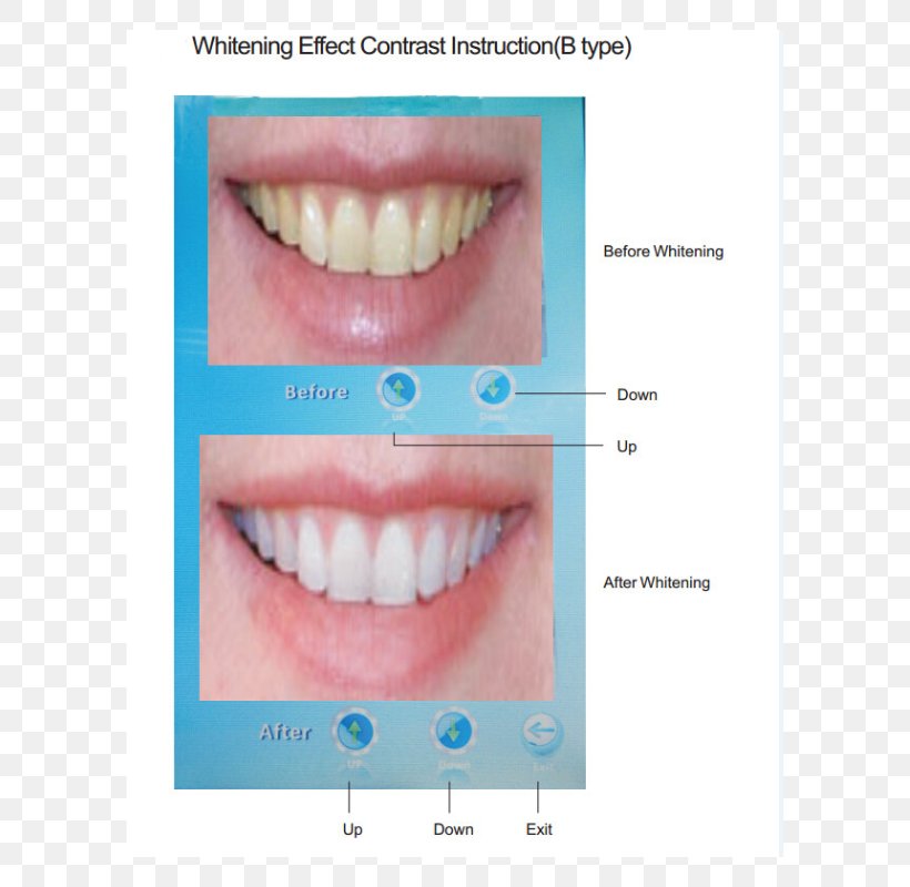 Close-up, PNG, 800x800px, Closeup, Cheek, Chin, Close Up, Cosmetic Dentistry Download Free