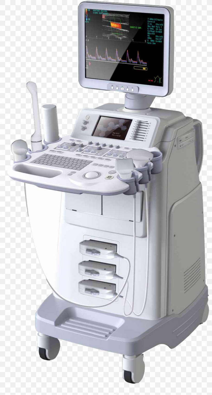 Ultrasonography 3D Ultrasound Doppler Echocardiography Medical Equipment, PNG, 858x1600px, 3d Ultrasound, Ultrasonography, Anaesthetic Machine, Doppler Echocardiography, Electronic Device Download Free
