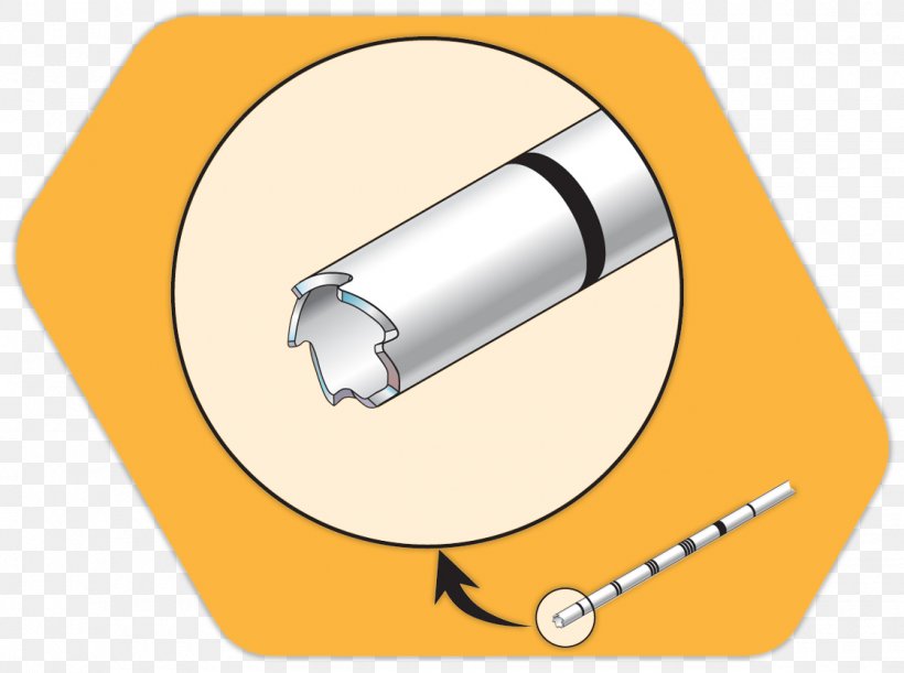 Biopsy Bone Marrow Examination Joint, PNG, 1120x835px, Biopsy, Bone, Bone Marrow, Bone Marrow Examination, Clinic Download Free