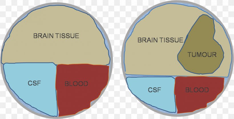 Doktryna Monro-Kelliego Brain Cerebrospinal Fluid Blood Hypothesis, PNG, 1316x671px, Doktryna Monrokelliego, Area, Blood, Brain, Cerebrospinal Fluid Download Free