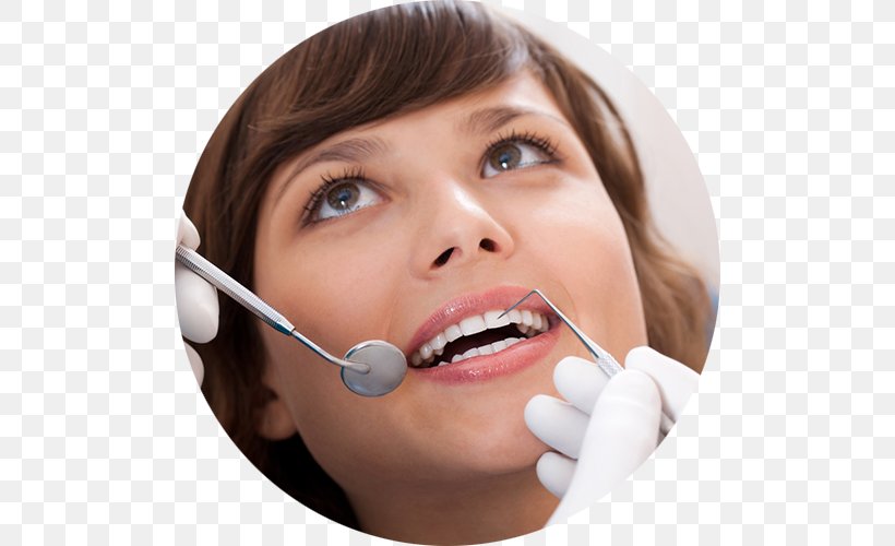 Dentistry Orthodontics Therapy Feya,, PNG, 500x500px, Dentistry, Cheek, Chin, Cosmetic Dentistry, Dental Implant Download Free