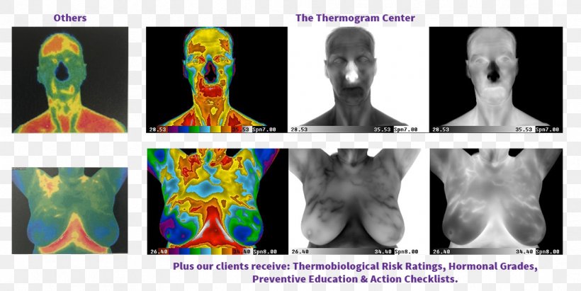 Thermography Medical Imaging Human Body Medicine, PNG, 1086x545px, Watercolor, Cartoon, Flower, Frame, Heart Download Free
