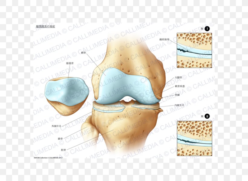 Tibia Knee Pain Bone Fracture Joint, PNG, 600x600px, Tibia, Back Pain, Bone, Bone Fracture, Carpal Bones Download Free