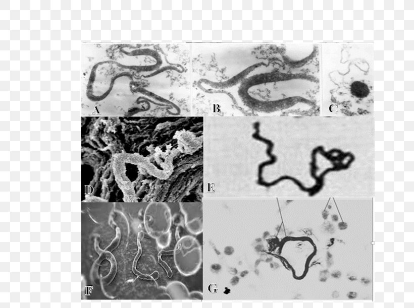 L-form Bacteria Microscope Virus Tuberculosis, PNG, 666x611px, Lform Bacteria, Bacteria, Black And White, Cell, Cell Wall Download Free
