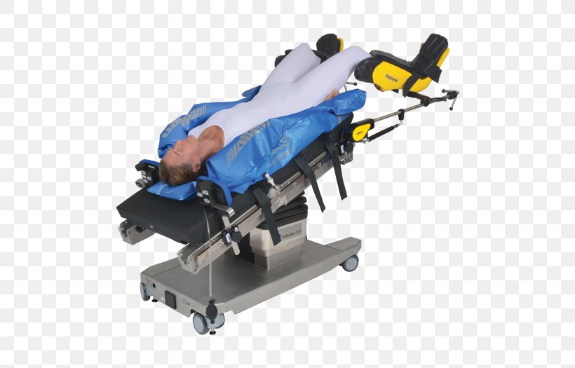 Trendelenburg Position Surgery Operating Table Gynaecology Allen Medical Systems, Inc., PNG, 525x525px, Trendelenburg Position, Advamed, Allen Medical Systems Inc, Bariatrics, Gynaecology Download Free