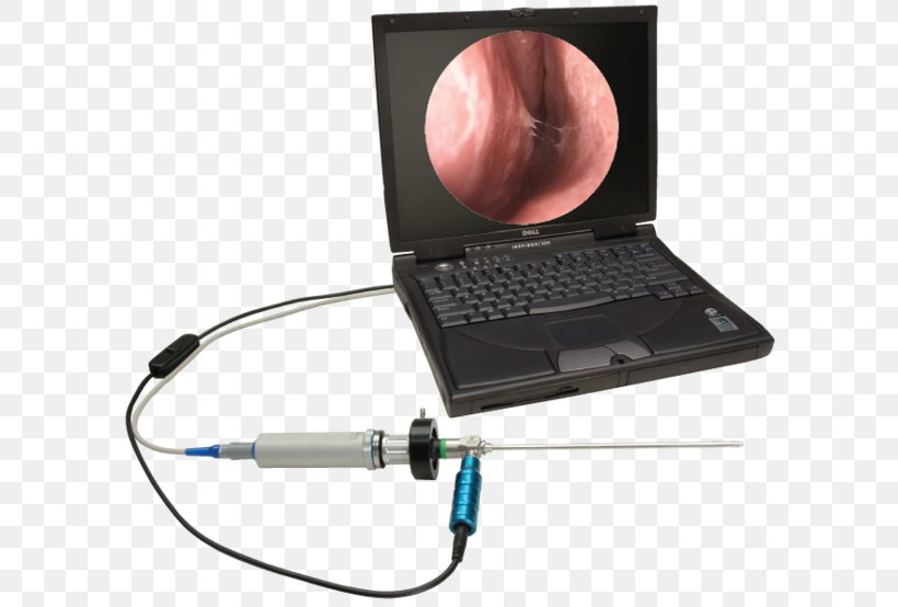 Capsule Endoscopy Otorhinolaryngology Video Cameras Physician, PNG, 600x554px, Endoscopy, Camera, Capsule Endoscopy, Colposcopy, Electronic Device Download Free