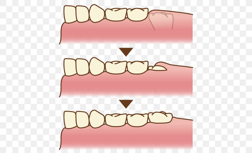 Tooth Molar Dentistry Clip Art, PNG, 500x500px, Watercolor, Cartoon, Flower, Frame, Heart Download Free