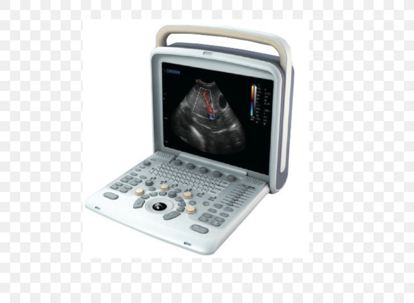 Ultrasonography Portable Ultrasound Obstetrics And Gynaecology Radiology, PNG, 586x600px, Ultrasonography, Doppler Echocardiography, Electronics, Gynaecology, Hardware Download Free