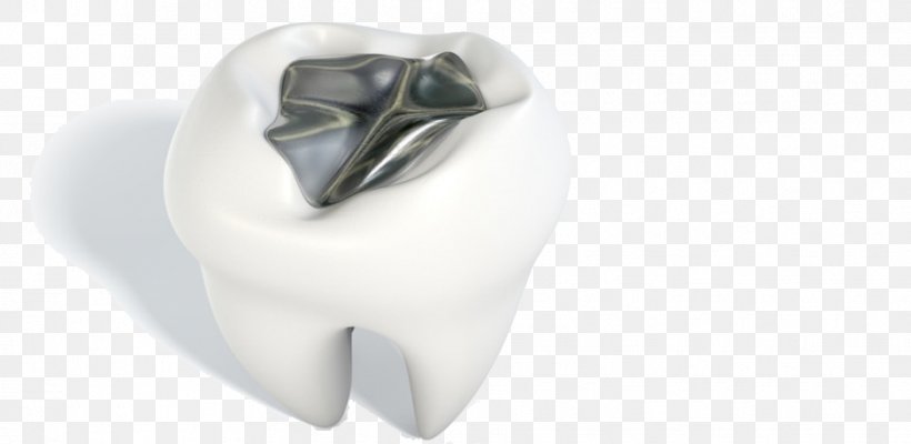Tooth Amalgam Silver Dentistry Metal, PNG, 939x459px, Watercolor, Cartoon, Flower, Frame, Heart Download Free