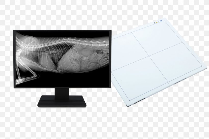 Digital Radiography Medical Imaging X-ray Radiology, PNG, 1118x745px, Digital Radiography, Efficiency, Flat Panel Display, Laptop, Laptop Part Download Free