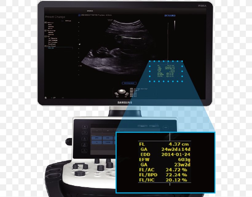 Ultrasound Ultrasonography Samsung Medison Samsung Electronics, PNG, 688x641px, Ultrasound, Business, Consumer Electronics, Display Device, Electronics Download Free