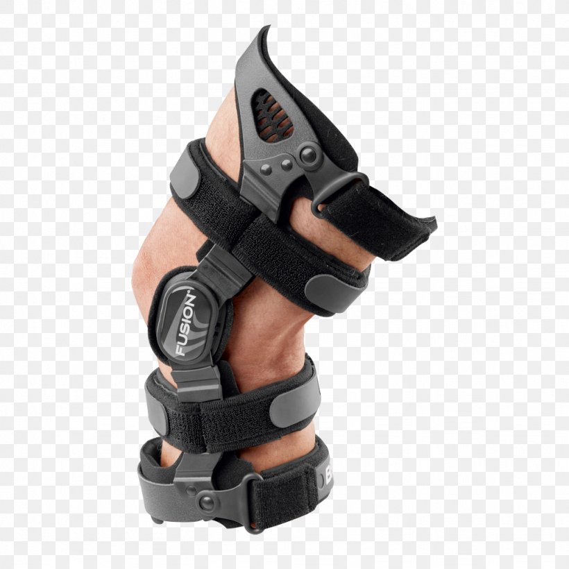 Anterior Cruciate Ligament Injury Posterior Cruciate Ligament Medial Collateral Ligament Dental Braces, PNG, 1024x1024px, Anterior Cruciate Ligament, Anterior Cruciate Ligament Injury, Dental Braces, Fibular Collateral Ligament, Hardware Download Free