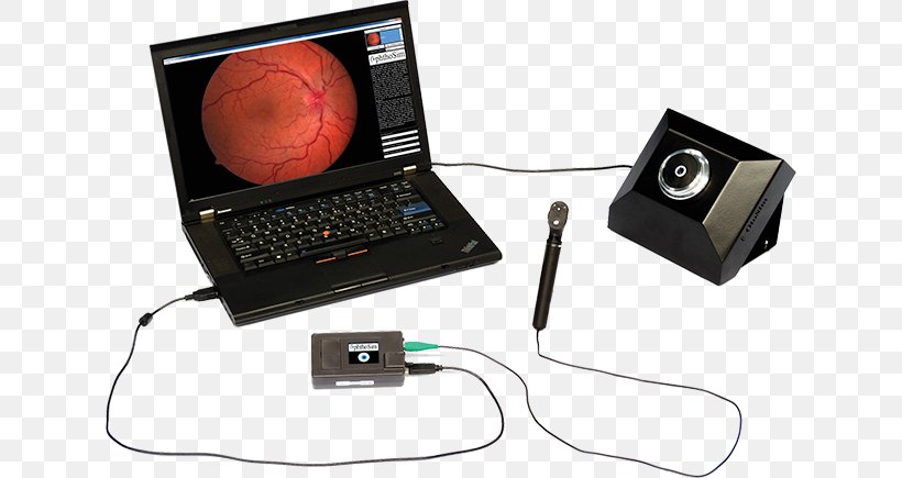 Ophthalmoscopy Simulation Virtual Reality Simulator Virtuality, PNG, 628x435px, Ophthalmoscopy, Communication, Echocardiography, Electronic Device, Electronics Download Free