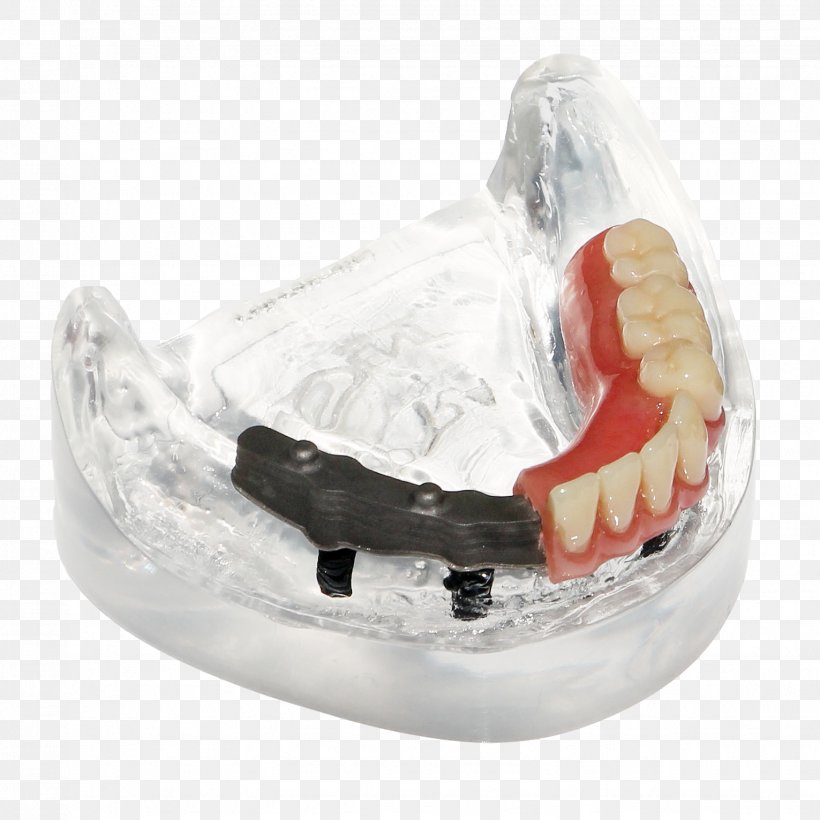 Dentures Tooth Made, Netherlands Digital Data .be, PNG, 1531x1531px, Dentures, Digital Data, Jaw, Made Netherlands, State Of The Art Download Free