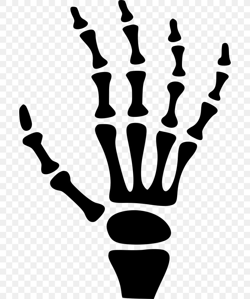 Carpal Bones Human Skeleton Hand, PNG, 696x980px, Bone, Black And White, Carpal Bones, Finger, Hand Download Free