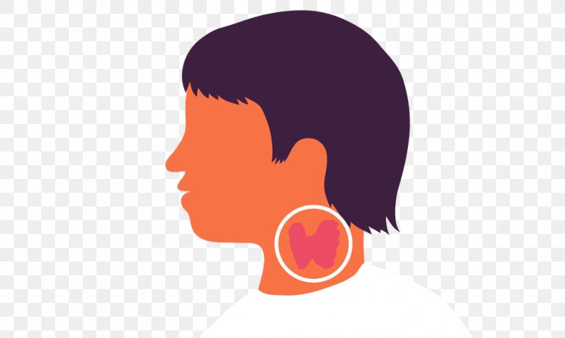 Thyroid Cancer Disease Hashimoto's Encephalopathy Iodine, PNG, 1000x600px, Thyroid, Cheek, Disease, Ear, Encephalopathy Download Free