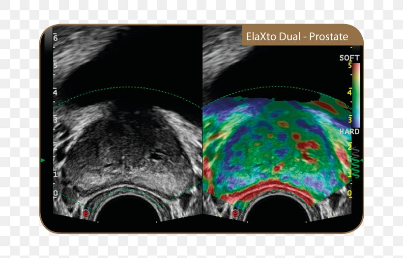 Ultrasonography Medicine Bmt Medtekhnika Medical Equipment Magnetic Resonance Imaging, PNG, 700x525px, Ultrasonography, Encyclopedia, Human Factors And Ergonomics, Magnetic Resonance Imaging, Medical Equipment Download Free