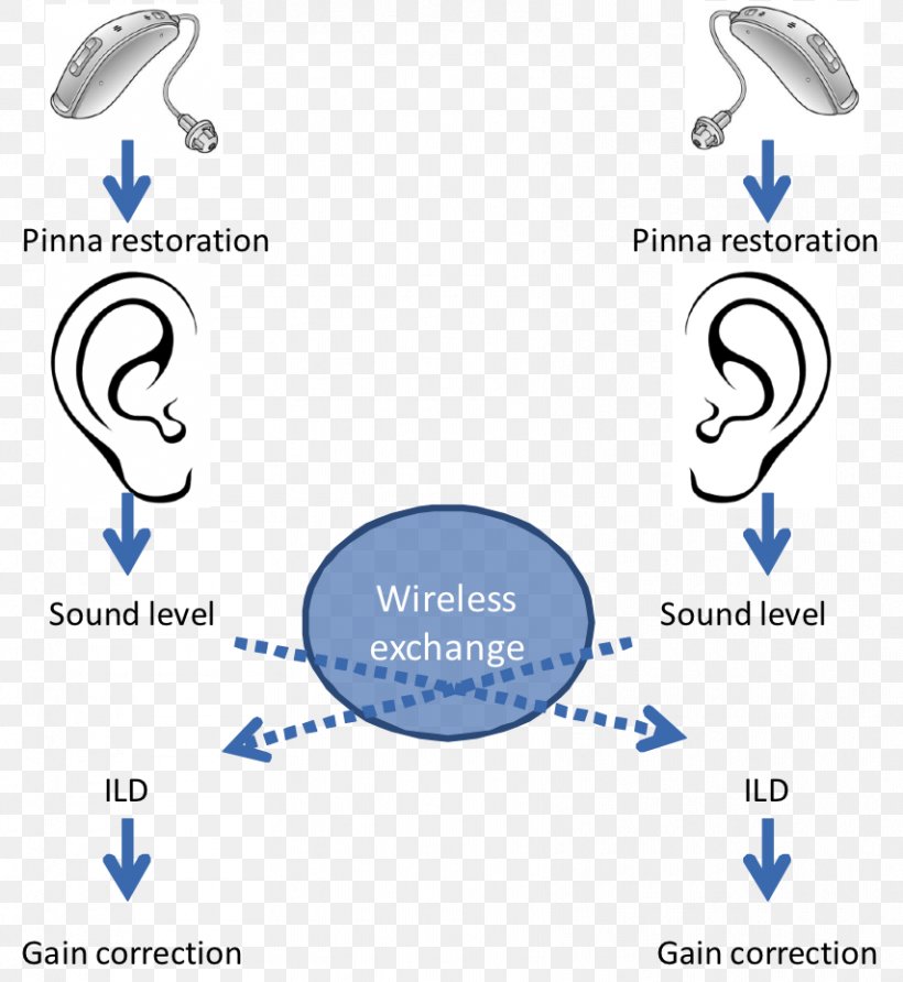 Binaural Hearing Aids Hearing Loss, PNG, 854x930px, Hearing Aid, Area, Auricle, Binaural Recording, Blue Download Free