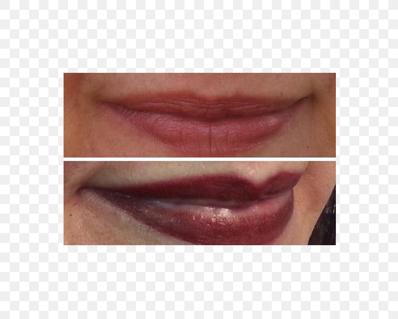 Lipstick Pigment Permanent Makeup Scalp, PNG, 582x657px, Lip, Artist, Chin, Close Up, Cosmetics Download Free