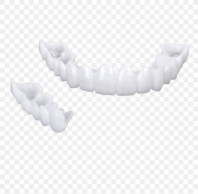 Veneer Dentures Tooth Whitening Dentistry, PNG, 2913x2848px, Veneer, Dentistry, Dentures, Hygiene, Jaw Download Free