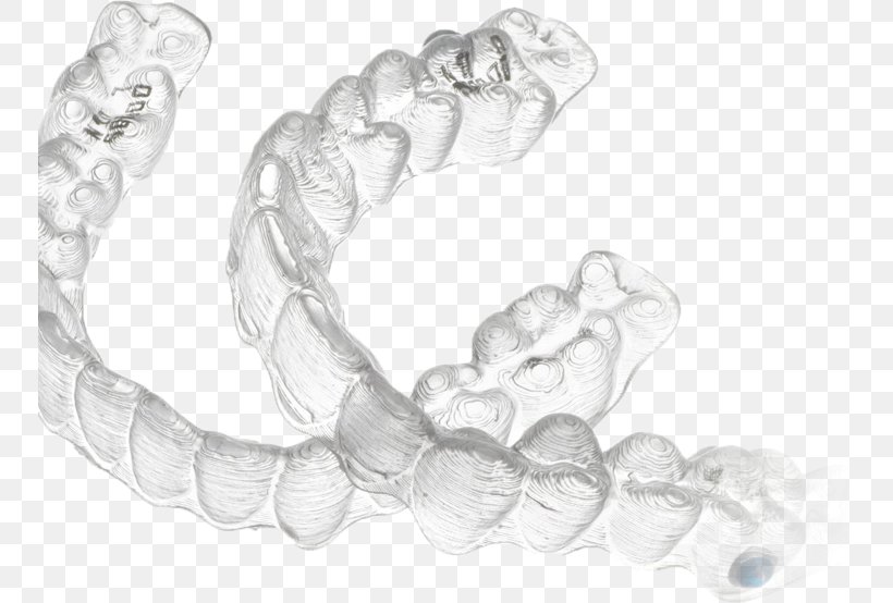 Clear Aligners Orthodontics Dentistry Dental Braces Sunnyvale Dental Aesthetics, PNG, 749x554px, Clear Aligners, Black And White, Body Jewelry, Bracelet, Chain Download Free