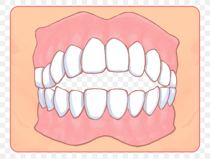 矯正歯科 Dental Braces Dentist Dentition Therapy, PNG, 792x622px, Watercolor, Cartoon, Flower, Frame, Heart Download Free
