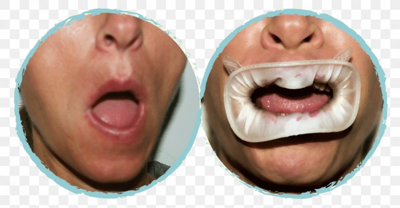 Nose Chin Cheek Jaw Mouth, PNG, 838x436px, Nose, Cheek, Chin, Close Up, Closeup Download Free