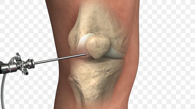 Orthopedic Surgery Knee Lipogems International SpA Therapy, PNG, 1920x1080px, Surgery, Healing, Joint, Knee, Muscle Download Free